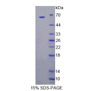 SDS-PAGE analysis of Human BEST1 Protein.