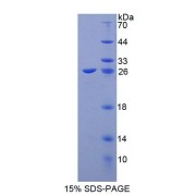 SDS-PAGE analysis of Human CIB1 Protein.