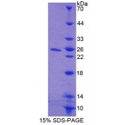 SDS-PAGE analysis of Mouse CISH Protein.