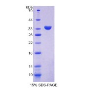 SDS-PAGE analysis of Human CHN2 Protein.