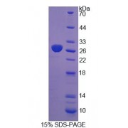 SDS-PAGE analysis of Rat DTNBP1 Protein.