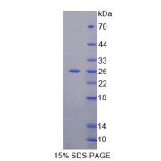 SDS-PAGE analysis of recombinant Human FBS Protein.