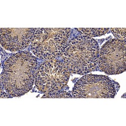 Heat Shock 90 kDa Beta 1 Protein (HSP90b1) Antibody