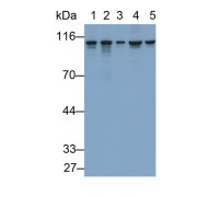 WB analysis of Lane 1: 293T cell lysate, Lane 2: A431 cell lysate, Lane 3: A549 cell lysate, Lane 4: HeLa cell lysate and Lane 5: K562 cell lysate, using HSP90b1 Antibody (0.2 µg/ml).