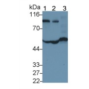 Western blot analysis of (1) Human Serum, (2) Human Plasma, (3) Human Lung lysate, using Mouse Anti-Human a1AT Antibody (0.2 µg/ml) and HRP-conjugated Goat Anti-Mouse antibody (<a href="https://www.abbexa.com/index.php?route=product/search&amp;search=abx400001" target="_blank">abx400001</a>, 0.2 µg/ml).
