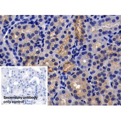 Angiotensin I Converting Enzyme 2 (ACE2) Antibody