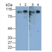 Western blot analysis of (1) Rat Heart lysate, (2) Rat Kidney lysate, (3) 293T cell lysate, (4) Rat Cerebrum lysate, using Mouse Anti-Rat IGF1 Antibody (0.5 µg/ml) and HRP-conjugated Goat Anti-Mouse antibody (<a href="https://www.abbexa.com/index.php?route=product/search&amp;search=abx400001" target="_blank">abx400001</a>, 0.2 µg/ml).
