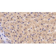 IHC-P analysis of Human Liver Tissue, with DAB staining, using Mouse Anti-Human BAI3 Antibody (30 µg/ml) and HRP-conjugated Goat Anti-Mouse antibody (<a href="https://www.abbexa.com/index.php?route=product/search&amp;search=abx400001" target="_blank">abx400001</a>, 2 µg/ml).