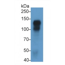 Cadherin 5 (CDH5) Antibody