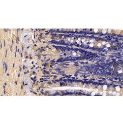 Calreticulin (CALR) Antibody