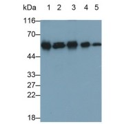 Western blot analysis of (1) Rat Liver lysate, (2) HeLa cell lysate, (3) HepG2 cell lysate, (4) HL60 cell lysate, and (5) Rat Cerebrum lysate, using Mouse Anti-Rat CALR Antibody (0.2 µg/ml) and HRP-conjugated Goat Anti-Mouse antibody (<a href="https://www.abbexa.com/index.php?route=product/search&amp;search=abx400001" target="_blank">abx400001</a>, 0.2 µg/ml).