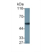 Western blot analysis of Human Placenta lysate, using Mouse Anti-Human F9 Antibody (0.5 µg/ml) and HRP-conjugated Goat Anti-Mouse antibody (<a href="https://www.abbexa.com/index.php?route=product/search&amp;search=abx400001" target="_blank">abx400001</a>, 0.2 µg/ml).