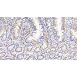 Cofilin 1, Non Muscle (CFL1) Antibody