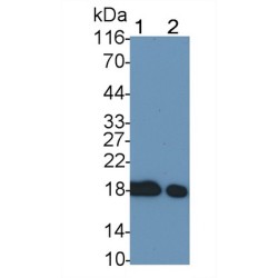 Cofilin 1, Non Muscle (CFL1) Antibody