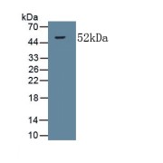 Western blot analysis of recombinant Human COL5a2.