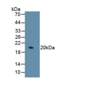 Western blot analysis of recombinant Collagen Type VIII Alpha 1 (COL8A1) using Collagen Type VIII Alpha 1 (COL8A1) Antibody.