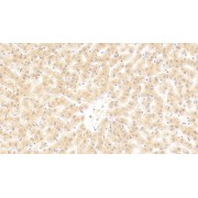 Immunohistochemistry analysis of paraffin-embedded Human Liver Tissue, with DAB staining, using Mouse Anti-Human C4b Antibody (30 µg/ml) and HRP-conjugated Goat Anti-Mouse antibody (<a href="https://www.abbexa.com/index.php?route=product/search&amp;search=abx400001" target="_blank">abx400001</a>, 2 µg/ml).