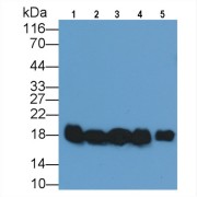 Western blot analysis of (1) Rat Liver lysate, (2) Rat Cerebrum lysate, (3) Rat Thymus lysate, (4) Rat Testis lysate, and (5) Rat Ovary lysate, using Mouse Anti-Rat CYPA Antibody (0.2 µg/ml) and HRP-conjugated Goat Anti-Mouse antibody (<a href="https://www.abbexa.com/index.php?route=product/search&amp;search=abx400001" target="_blank">abx400001</a>, 0.2 µg/ml).