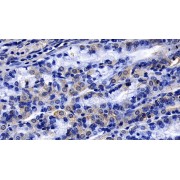 IHC-P analysis of Human Stomach Tissue, with DAB staining, using Mouse Anti-Human FGF9 Antibody (20 µg/ml) and HRP-conjugated Goat Anti-Mouse antibody (<a href="https://www.abbexa.com/index.php?route=product/search&amp;search=abx400001" target="_blank">abx400001</a>, 2 µg/ml).