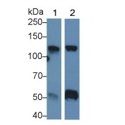 Western blot analysis of (1) Rat Heart lysate, (2) Rat Cerebrum lysate, using Mouse Anti-Human HK1 Antibody (0.5 µg/ml) and HRP-conjugated Goat Anti-Mouse antibody (<a href="https://www.abbexa.com/index.php?route=product/search&amp;search=abx400001" target="_blank">abx400001</a>, 0.2 µg/ml).