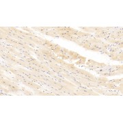 IHC-P analysis of Human Cardiac Muscle Tissue, with DAB staining, using Mouse Anti-Human ITGa11 Antibody (30 µg/ml) and HRP-conjugated Goat Anti-Mouse antibody (<a href="https://www.abbexa.com/index.php?route=product/search&amp;search=abx400001" target="_blank">abx400001</a>, 2 µg/ml).