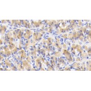 IHC-P analysis of Human Stomach Tissue, with DAB staining, using Mouse Anti-Human IL12B Antibody (20 µg/ml) and HRP-conjugated Goat Anti-Mouse antibody (<a href="https://www.abbexa.com/index.php?route=product/search&amp;search=abx400001" target="_blank">abx400001</a>, 2 µg/ml).