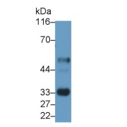 Western blot analysis of Rat Lymph node lysate, using Mouse Anti-Human IL2Ra Antibody (0.2 µg/ml) and HRP-conjugated Goat Anti-Mouse antibody (<a href="https://www.abbexa.com/index.php?route=product/search&amp;search=abx400001" target="_blank">abx400001</a>, 0.2 µg/ml).