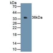 Western blot analuyis of recombinant Human MT1E.