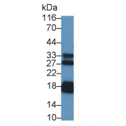 Western blot analysis of Rat Heart lysate, using Mouse Anti-Human NT-ProANP Antibody (0.2 µg/ml) and HRP-conjugated Goat Anti-Mouse antibody (<a href="https://www.abbexa.com/index.php?route=product/search&amp;search=abx400001" target="_blank">abx400001</a>, 0.2 µg/ml).