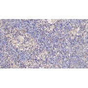 IHC-P analysis of Human Spleen Tissue, with DAB staining, using Mouse Anti-Human PRF1 Antibody (20 µg/ml) and HRP-conjugated Goat Anti-Mouse antibody (<a href="https://www.abbexa.com/index.php?route=product/search&amp;search=abx400001" target="_blank">abx400001</a>, 2 µg/ml).