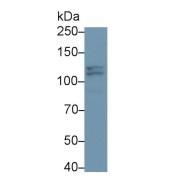 Western blot analysis of Jurkat cell lysate using Poly ADP Ribose Polymerase 1 (PARP1) Antibody (3 µg/ml) and HRP-conjugated Goat Anti-Mouse IgG Antibody (<a href="https://www.abbexa.com/goat-anti-mouse-igg-antibody-hrp-1">abx400001</a>, 0.2 µg/ml)