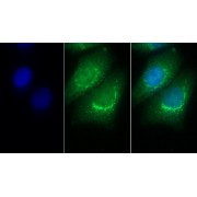 IF analysis of Human HepG2 cells, using Mouse Anti-Human PSAP Antibody (30 µg/ml) and FITC-conjugated Goat Anti-Mouse antibody (<a href="https://www.abbexa.com/index.php?route=product/search&amp;search=abx400031" target="_blank">abx400031</a>, 2 µg/ml).