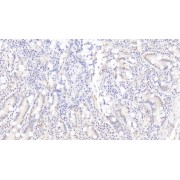 IHC-P analysis of Human Small intestine Tissue, with DAB staining, using Mouse Anti-Human Rac1 Antibody (30 µg/ml) and HRP-conjugated Goat Anti-Mouse antibody (<a href="https://www.abbexa.com/index.php?route=product/search&amp;search=abx400001" target="_blank">abx400001</a>, 2 µg/ml).