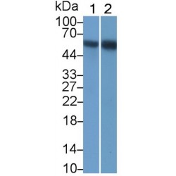 Receptor Interacting Serine Threonine Kinase 3 (RIPK3) Antibody