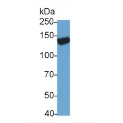 WB analysis of Rat serum, using TRPM4 Antibody (0.5 µg/ml).