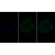 IF analysis of Human MCF7 cells, using Mouse Anti-Rat VEGFR2 Antibody (20 µg/ml) and FITC-conjugated Goat Anti-Mouse antibody (<a href="https://www.abbexa.com/index.php?route=product/search&amp;search=abx400031" target="_blank">abx400031</a>, 5 µg/ml).