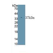 Western blot analysis of recombinant Rat ALPL.