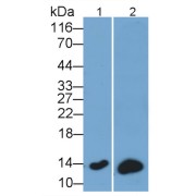 Western blot analysis of (1) Raji cell lysate, (2) Rat Spleen lysate, Rabbit Anti-Simian b2M Antibody (using 0.2 µg/ml) and HRP-conjugated Goat Anti-Rabbit antibody (<a href="https://www.abbexa.com/index.php?route=product/search&amp;search=abx400043" target="_blank">abx400043</a>, 0.2 µg/ml).