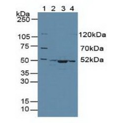 Citrate Synthase (CS) Antibody