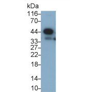 Western blot analysis of Rat Heart lysate, using Rabbit Anti-Human CRELD1 Antibody (0.5 µg/ml) and HRP-conjugated Goat Anti-Rabbit antibody (<a href="https://www.abbexa.com/index.php?route=product/search&amp;search=abx400043" target="_blank">abx400043</a>, 0.2 µg/ml).