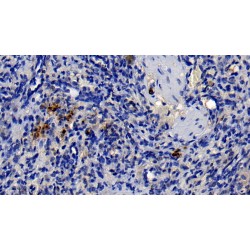 Neutrophil Elastase / ELA2 (ELANE) Antibody