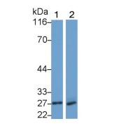 Western blot analysis of (1) Dog Bone marrow lysate, and (2) Human Leukocyte lysate, using Rabbit Anti-Dog NE Antibody (0.04 µg/ml) and HRP-conjugated Goat Anti-Rabbit antibody (<a href="https://www.abbexa.com/index.php?route=product/search&amp;search=abx400043" target="_blank">abx400043</a>, 0.2 µg/ml).