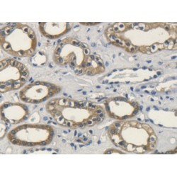 Fibroblast Growth Factor 10 (FGF10) Antibody