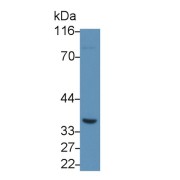 Western blot analysis of Mouse Skeletal muscle lysate, using Rabbit Anti-Human FGF23 Antibody (1.5 µg/ml) and HRP-conjugated Goat Anti-Rabbit antibody (<a href="https://www.abbexa.com/index.php?route=product/search&amp;search=abx400043" target="_blank">abx400043</a>, 0.2 µg/ml).