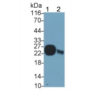 Western blot analysis of (1) Rat Liver lysate, and (2) Mouse Liver lysate, using Rabbit Anti-Rat GPX1 Antibody (0.04 µg/ml) and HRP-conjugated Goat Anti-Rabbit antibody (<a href="https://www.abbexa.com/index.php?route=product/search&amp;search=abx400043" target="_blank">abx400043</a>, 0.2 µg/ml).