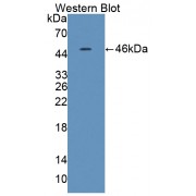 Western blot analysis of recombinant Rat IL21.