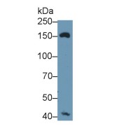 Western blot analysis of Mouse Liver lysate, using Rabbit Anti-Human MRC1 Antibody (1 µg/ml) and HRP-conjugated Goat Anti-Rabbit antibody (<a href="https://www.abbexa.com/index.php?route=product/search&amp;search=abx400043" target="_blank">abx400043</a>, 0.2 µg/ml).