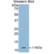 Western blot analysis of recombinant Human MUC21.