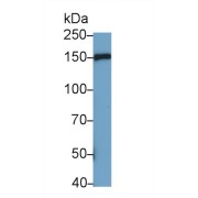 WB analysis of Rat heart lysate, using MYBPC3 Antibody (0.2 µg/ml).