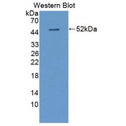 WB analysis of recombinant Mouse PLIN1.